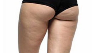 a-kak-po-vashemu-rabotat-s-problemnymi-bedrami