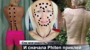 сон с пластырями phiten Milena Poznyak